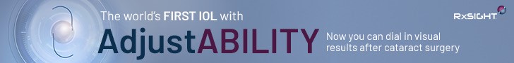 RxSight Banner Ad