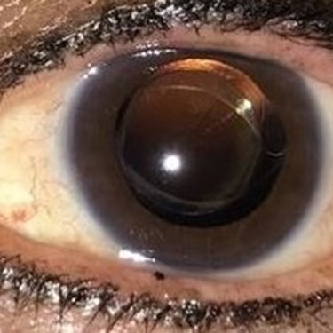 20 Happy 2020 happy patients